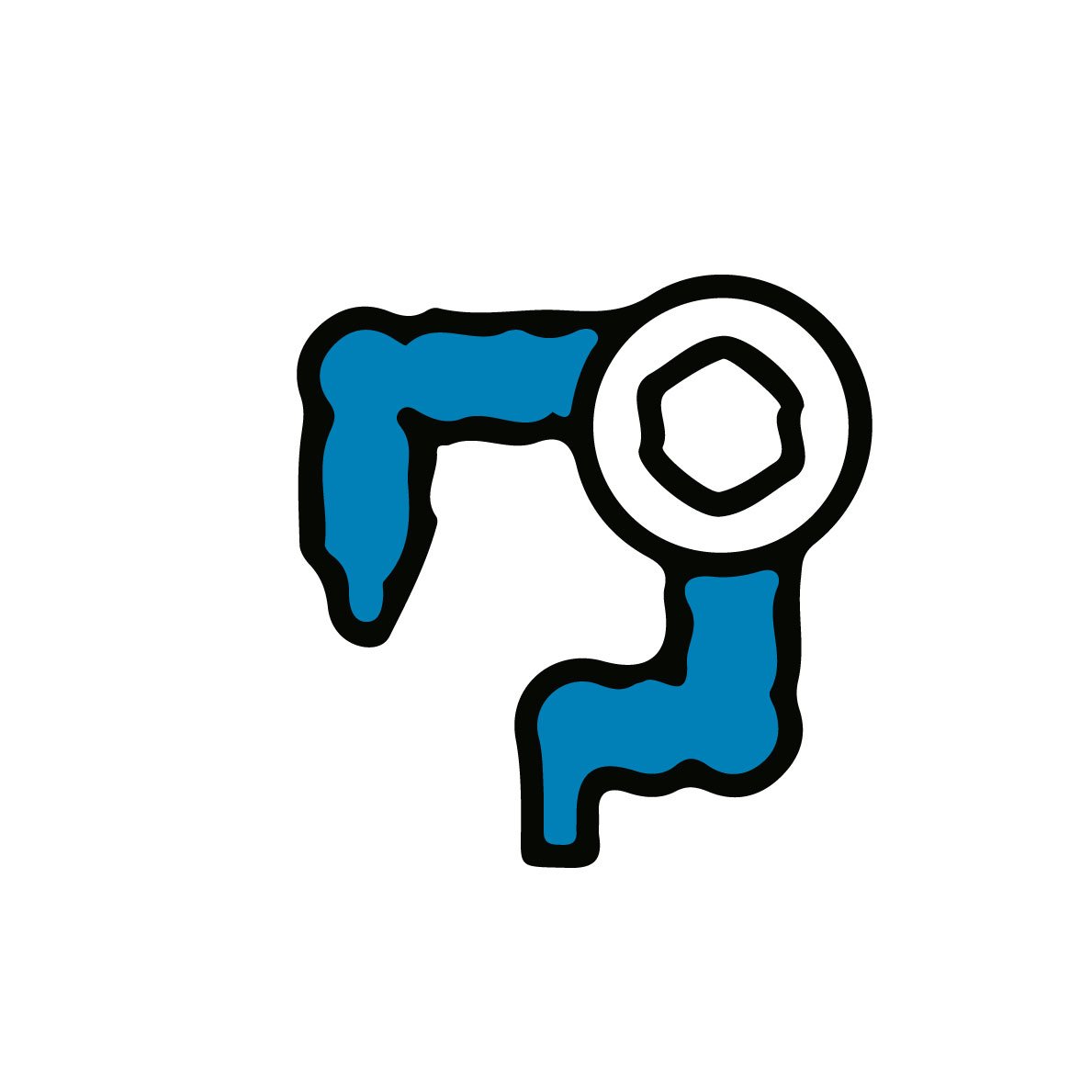 استئصال أورام القولون (جراحة ومنظار)